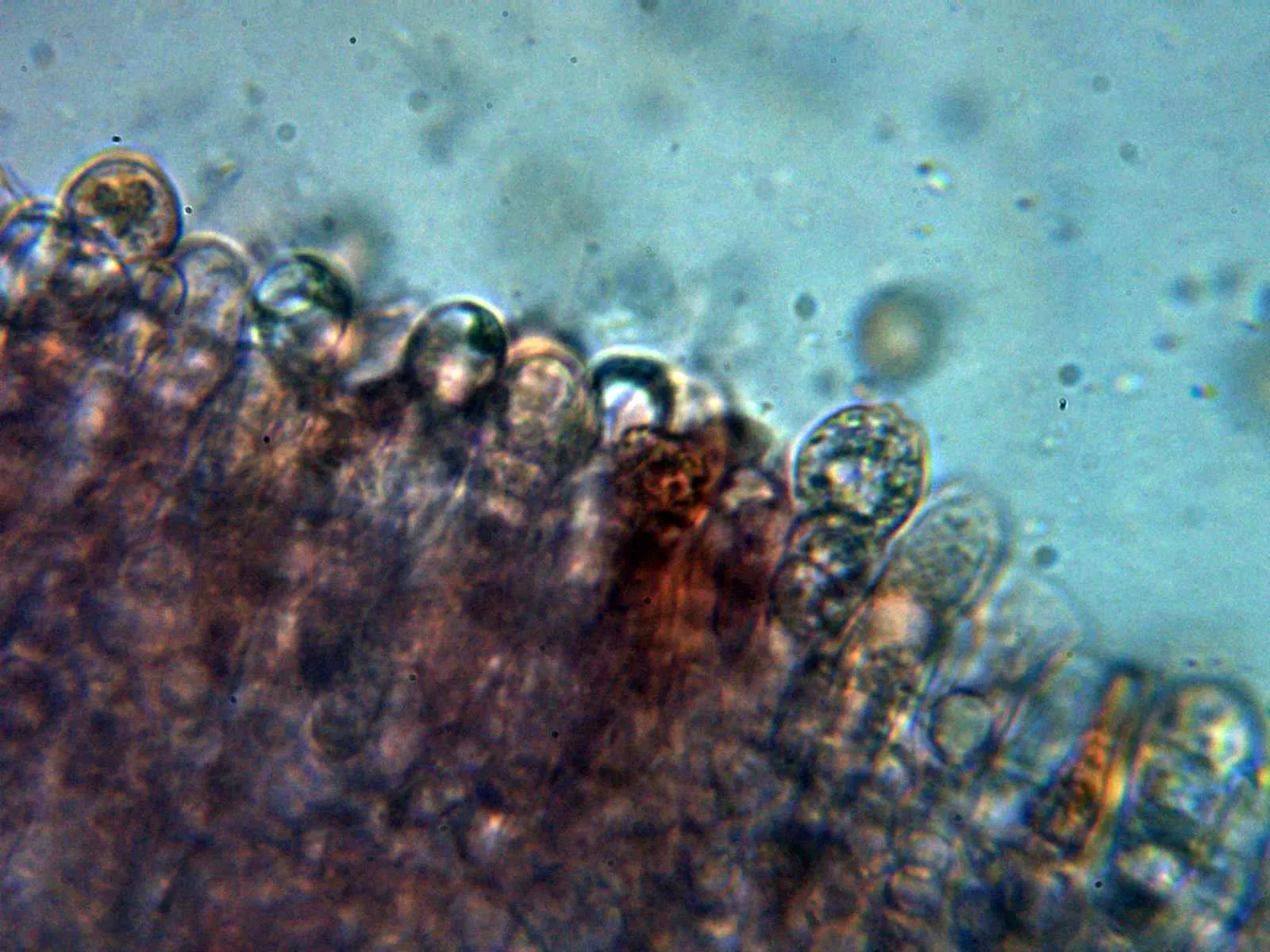 Microscopía de Russula rosea - 10 - Himenio 3